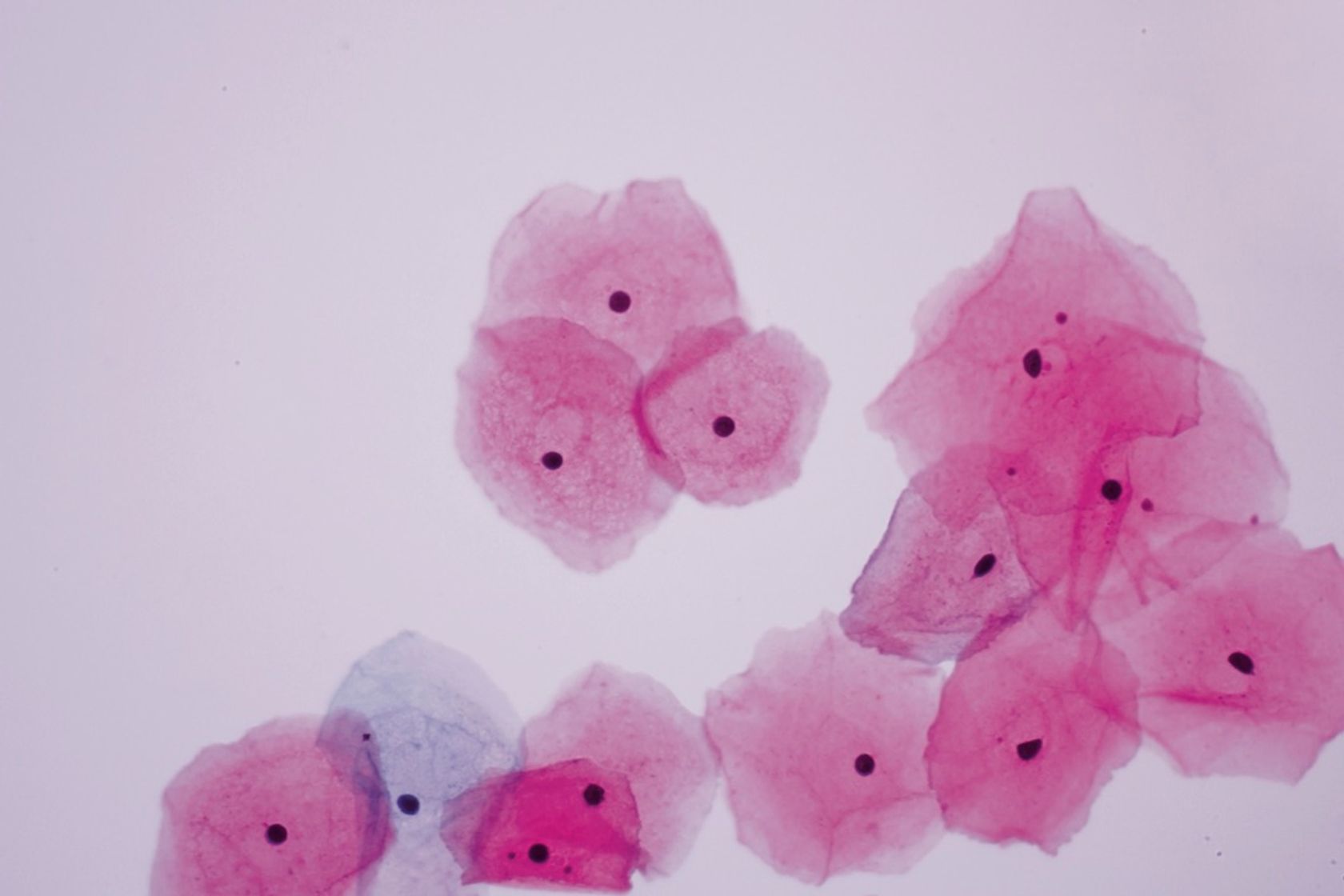 Zervixzellen unterm Mikroskop