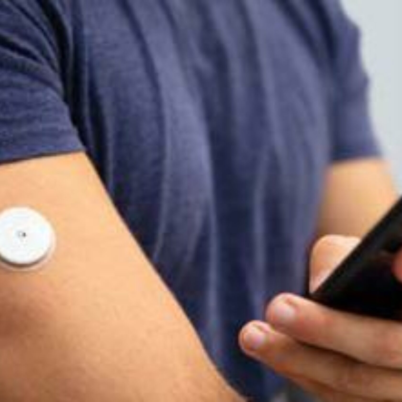 Mann hat ein CGM-Gerät zur Blutzuckermessung am Oberarm und kontrolliert seinen Blutzucker mittels Smartphone.