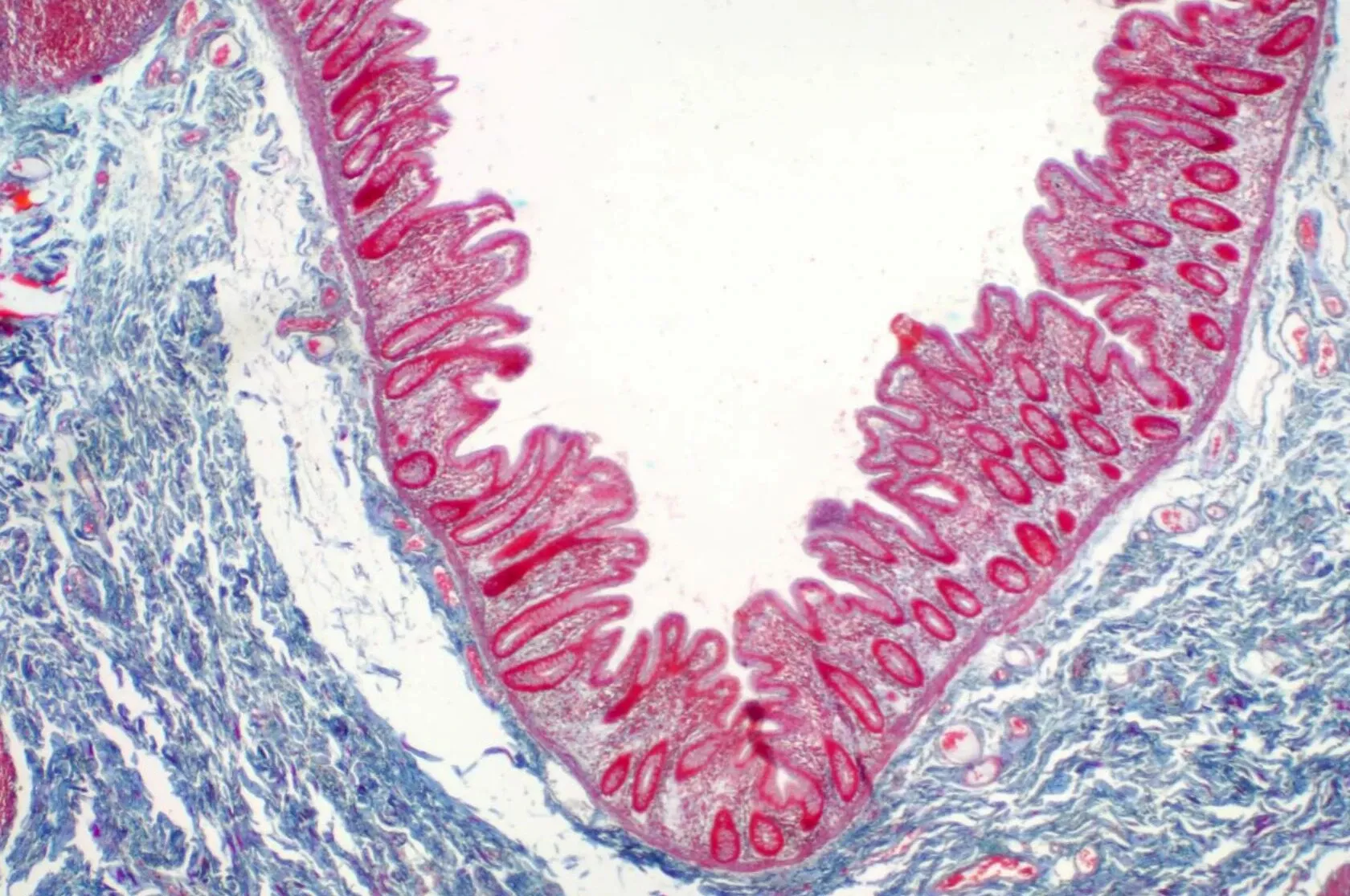 Darmentzündung unter dem Mikroskop