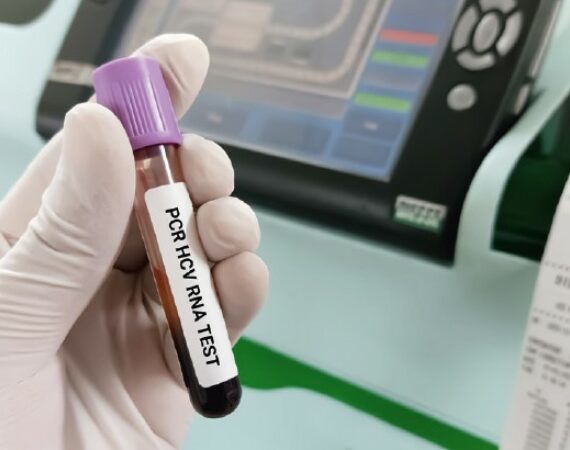 Test-Röhrchen mit Blutprobe