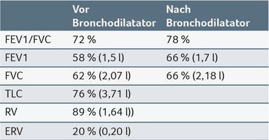 Die Tabelle zeigt Lungenfunktionswerte vor und nach Bronchodilatator.
