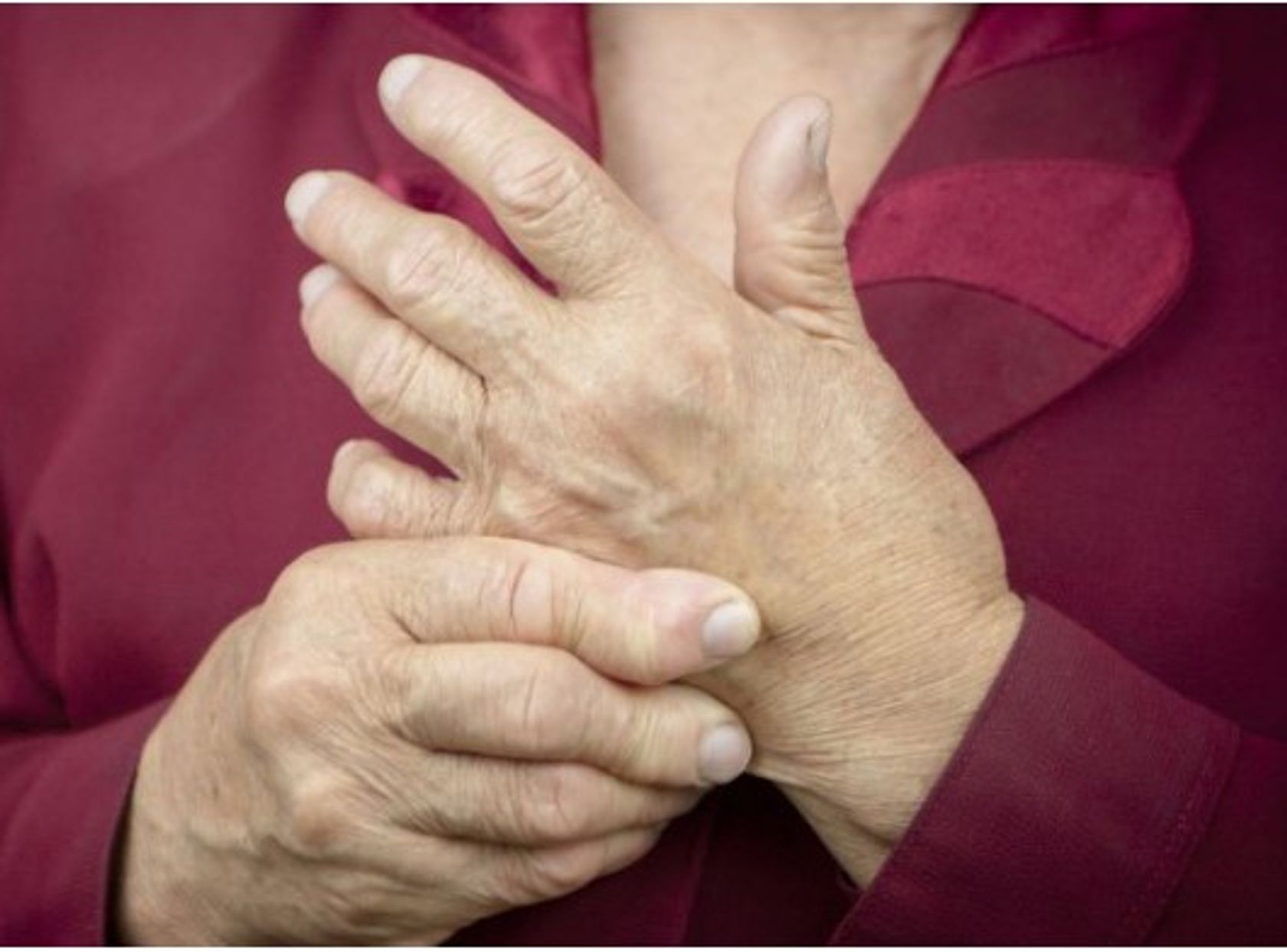 Person reibt oder hält sich die Hände. Die Finger sind verformt von rheumatoider Arthritis.