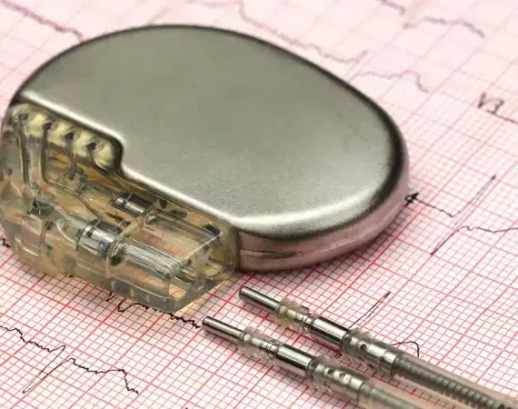 Herzschrittmacher auf EKG-Papier