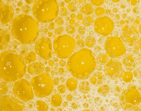 Gelbe Flüssigkeit - soll Urin darstellen.