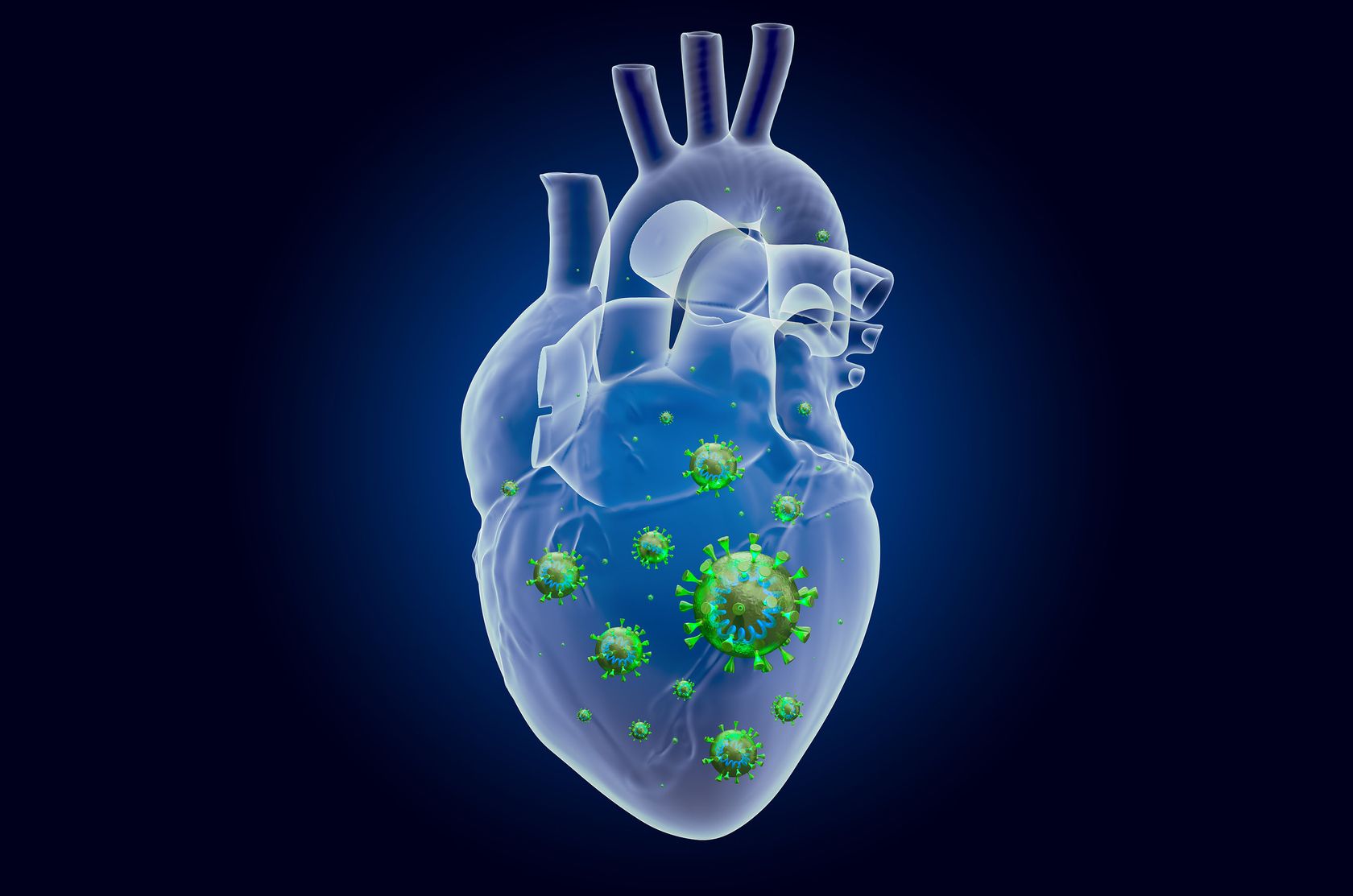 3D-Illustration von einem Herz mit Covid-Viren innen