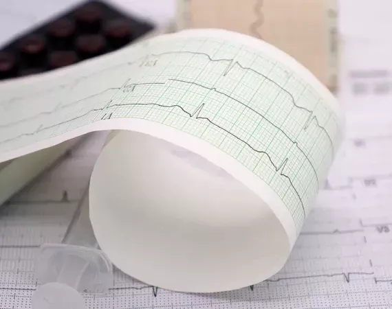 Ausdruck der EKG-Kurve kommt aus dem Messgerät.